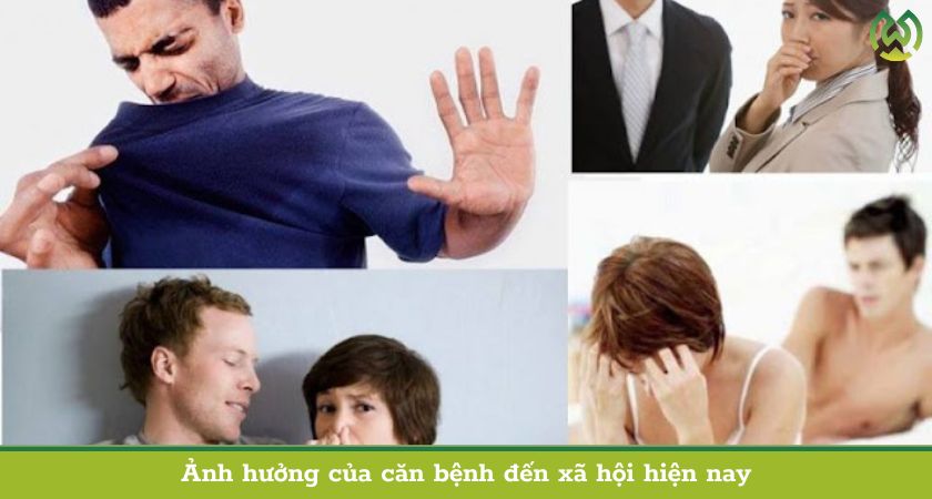 Ảnh hưởng của căn bệnh viêm cánh đến xã hội hiện nay