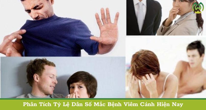 Phân Tích Tỷ Lệ Dân Số Mắc Bệnh Viêm Cánh Hiện Nay