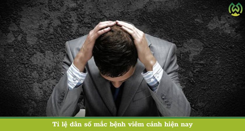 Tỉ lệ dân số mắc bệnh viêm cánh hiện nay