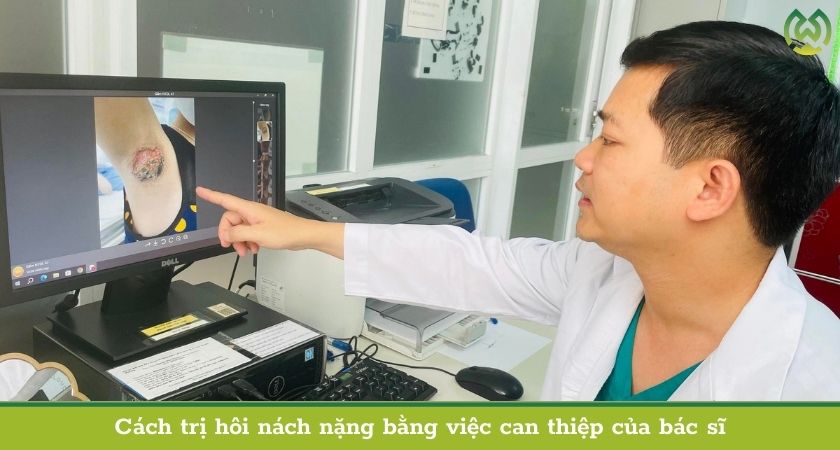 Cách trị hôi nách nặng bằng việc can thiệp của bác sĩ